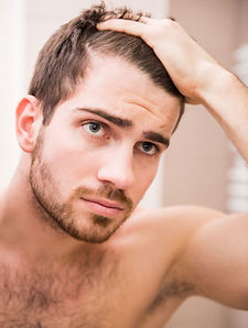 male-hair-loss.jpg
