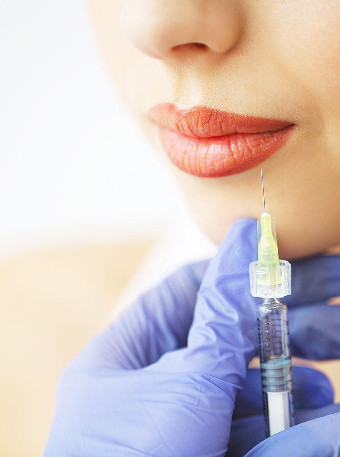 Dermal filler treatment
