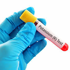 Pottasium ISE Serum