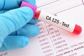 CA-125