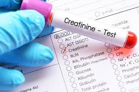 Creatinine Serum