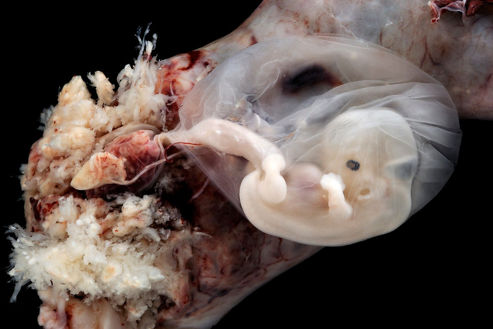 An image of an ectopic pregnancy, at the 6-7 week gestation stage within the fallopian tube.
