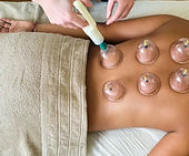 CUPPING ON LOWER BACK TO HELP WITH LOWER BACK TENSION 