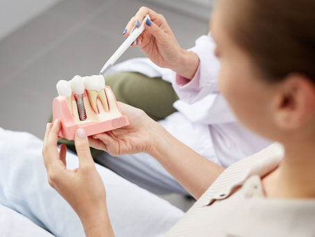 Dental Implants Specialist in Lake Forest, CA