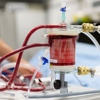 Apersys hat ein weltweit einzigartiges System entwickelt: ein Medizingerät, mit dem man die menschliche Leber ausserhalb des Körpers bis zu 7 Tage lang maschinell perfundieren und damit am Leben erhalten kann.