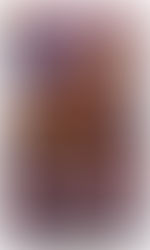 The Undead Fox of Deadwood Forest