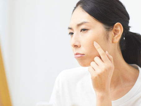 Why your skin reacts weeks later: the truth about delayed skin reactions