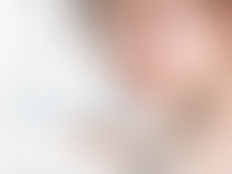 Glass Skin Treatment in Gothenburg – 5th Generation Korea Peel at Instaskin