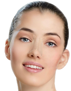 Model With Le Med Nose Splint
