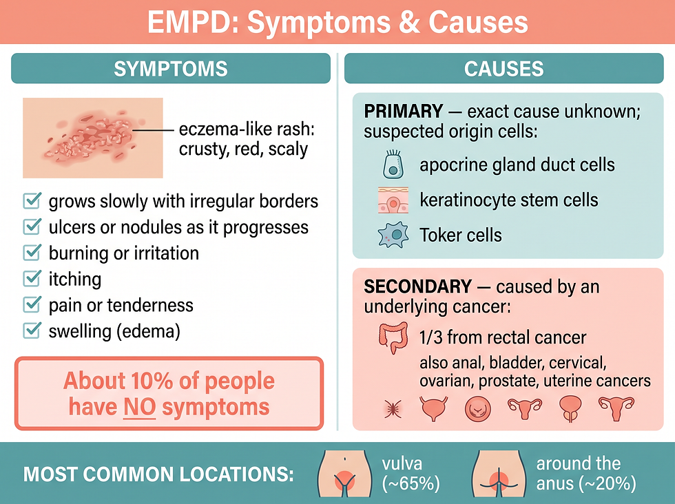 Extramammary Paget's disease symptom and cause infographic showing the eczema-like rash, affected body locations with the 65% vulva and 20% perianal statistics, primary vs secondary causes, and the 10% symptom-free figure