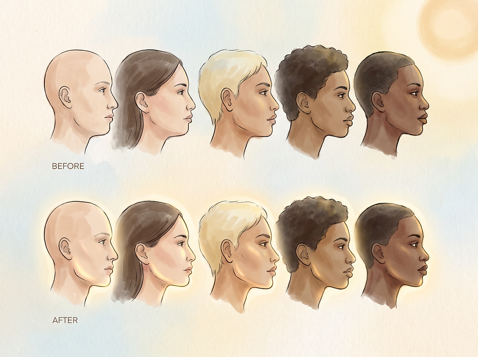 Illustration of diverse facial profiles before and after jawline filler showing natural-looking definition of the lower face