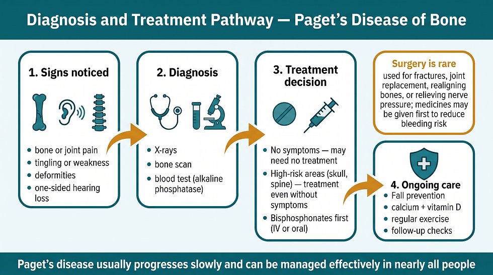 Diagnosis and treatment pathway for Paget's disease of bone — four-stage flowchart from signs noticed through diagnosis, treatment decision, and ongoing care
