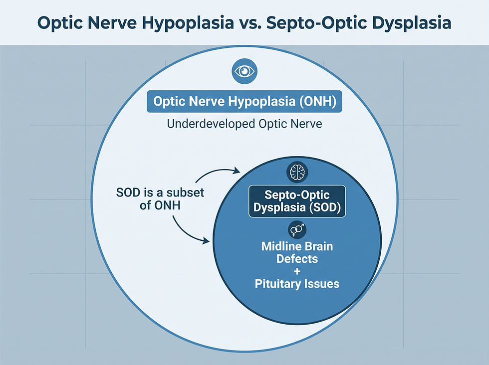Venn-style diagram showing septo-optic dysplasia as a subset of optic nerve hypoplasia