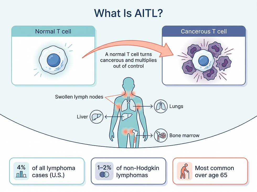 AITL overview: what the cancer is, who it affects, and how rare it is