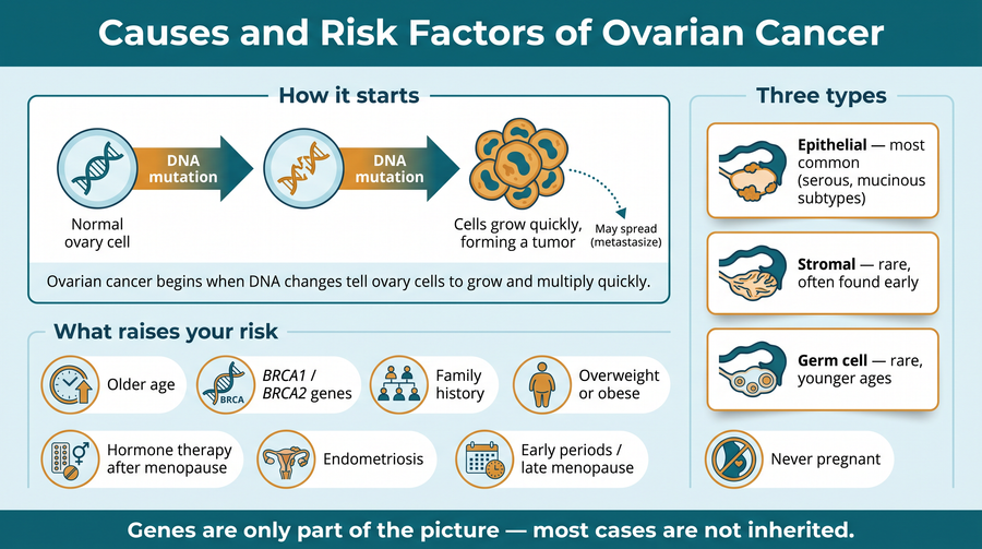 Causes and risk factors of ovarian cancer, including age, BRCA gene changes, family history, and other factors