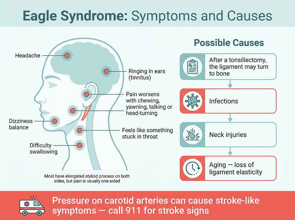 Eagle syndrome symptoms, possible causes and the stroke warning