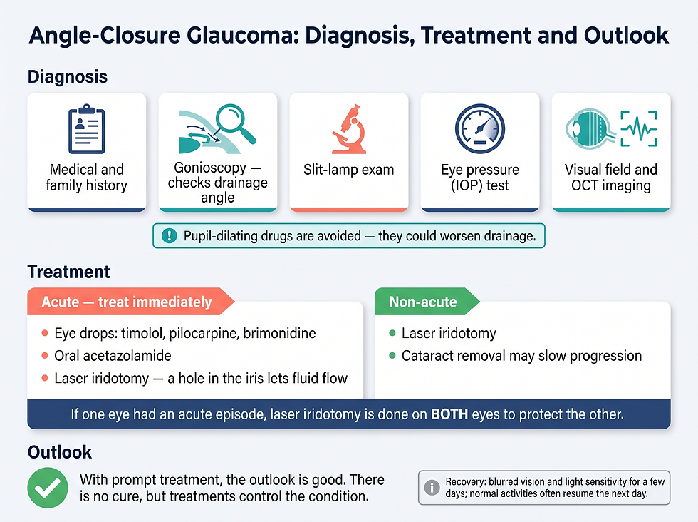 Diagnosis, treatment, and outlook for angle-closure glaucoma