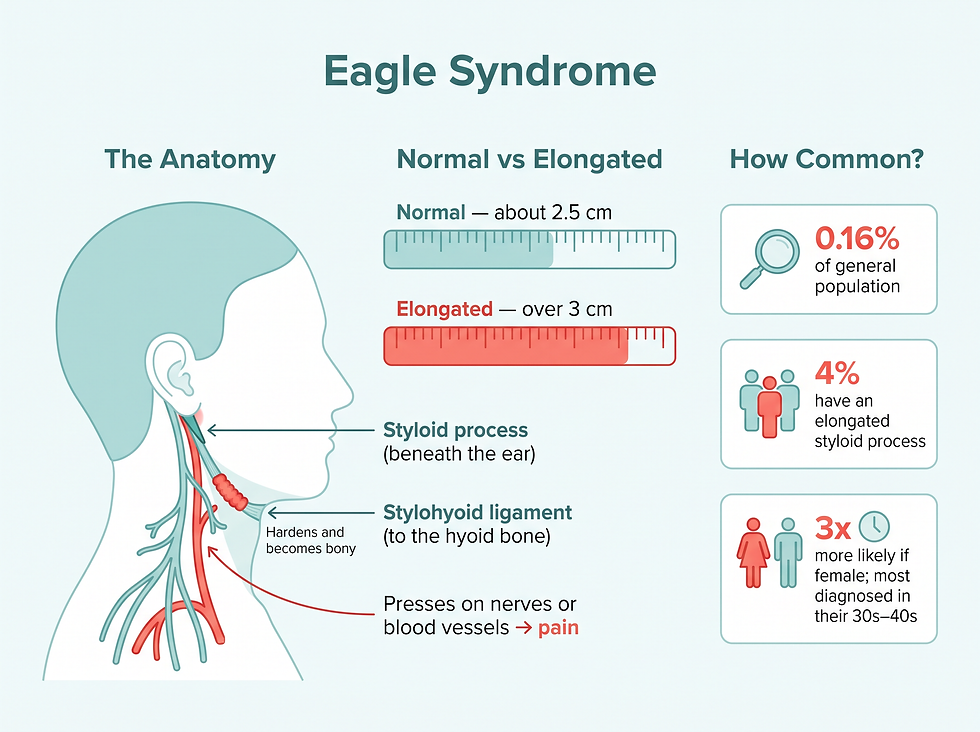 What Eagle syndrome is: styloid process anatomy, how common it is and who gets it
