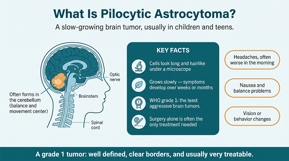 What is pilocytic astrocytoma — a slow-growing brain tumor that usually affects children and teens