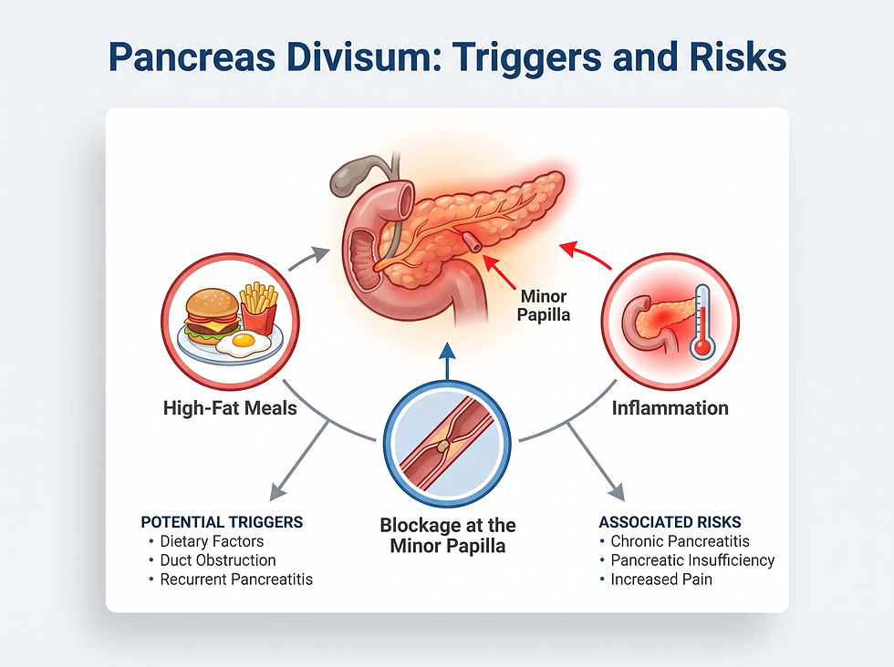 Infographic outlining the risk factors and triggers for pancreatitis in individuals with pancreas divisum.