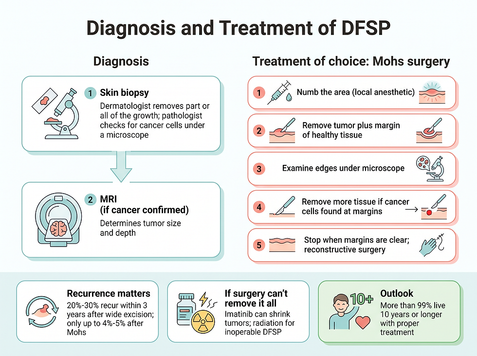 DFSP diagnosis and treatment: skin biopsy and MRI, then step-by-step Mohs surgery, recurrence rates, options if surgery can't remove it all, and the outlook
