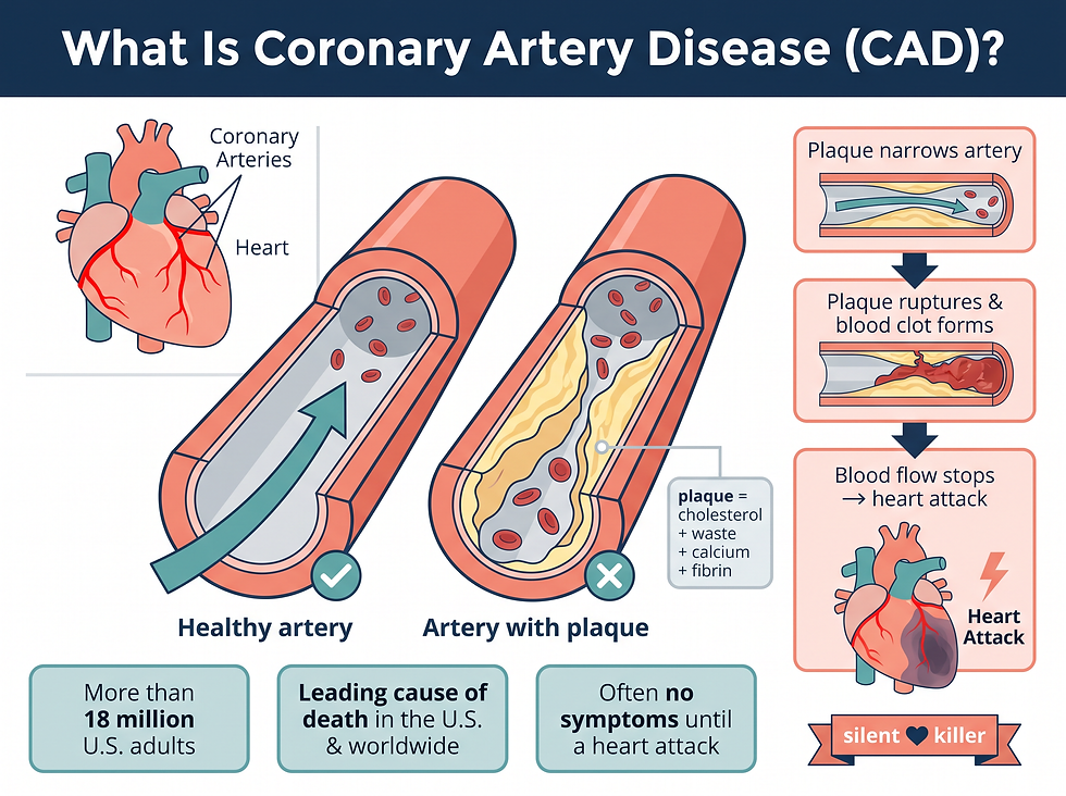 What is coronary artery disease — plaque narrowing the coronary arteries and how it leads to a heart attack