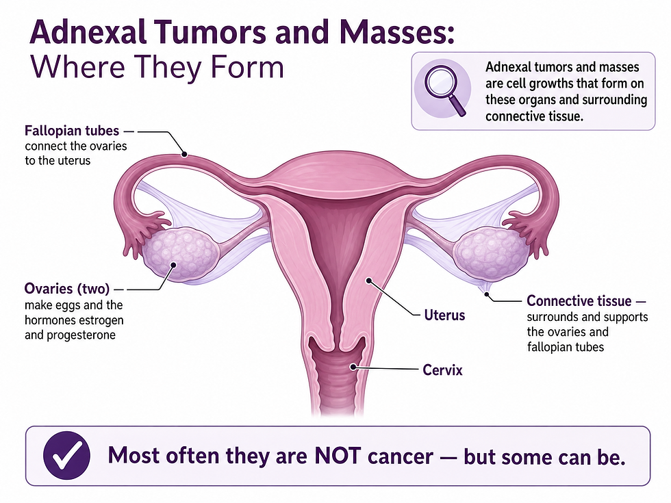Diagram showing where adnexal tumors and masses form in the female reproductive system