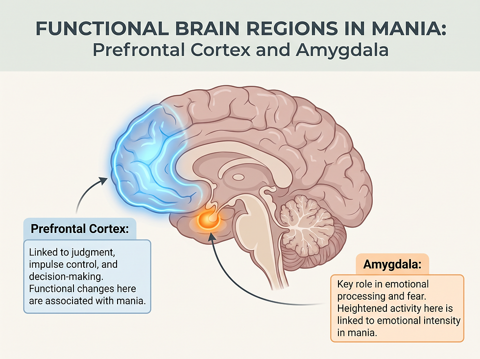 A professional medical diagram showing the brain regions associated with mania, including the prefrontal cortex and amygdala, with labels explaining how functional differences may affect judgment and emotion.