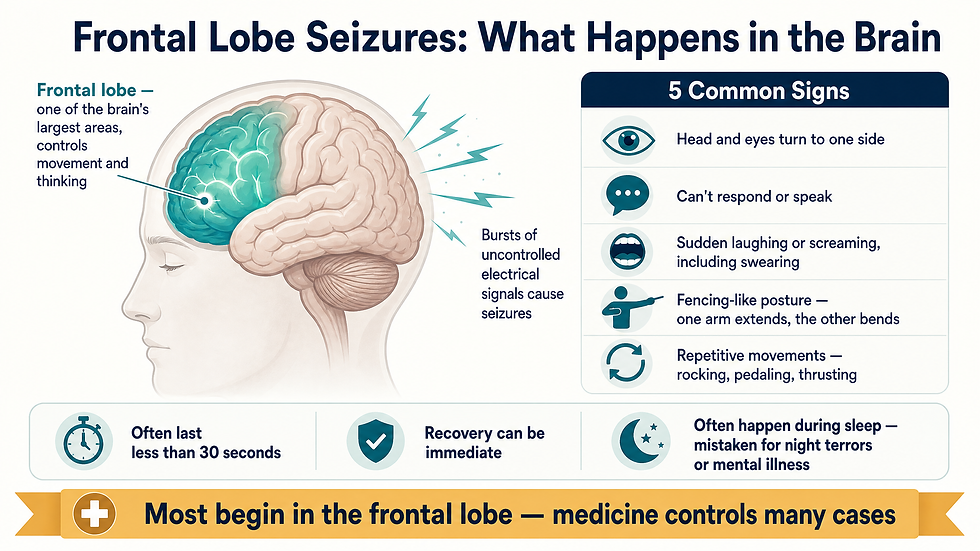 Frontal lobe seizures begin in the brain's frontal lobe when clusters of brain cells fire uncontrolled electrical bursts. The seizures are brief — often under 30 seconds — and often happen during sleep, which is why they are commonly mistaken for night terrors, sleep disorders, or mental illness.