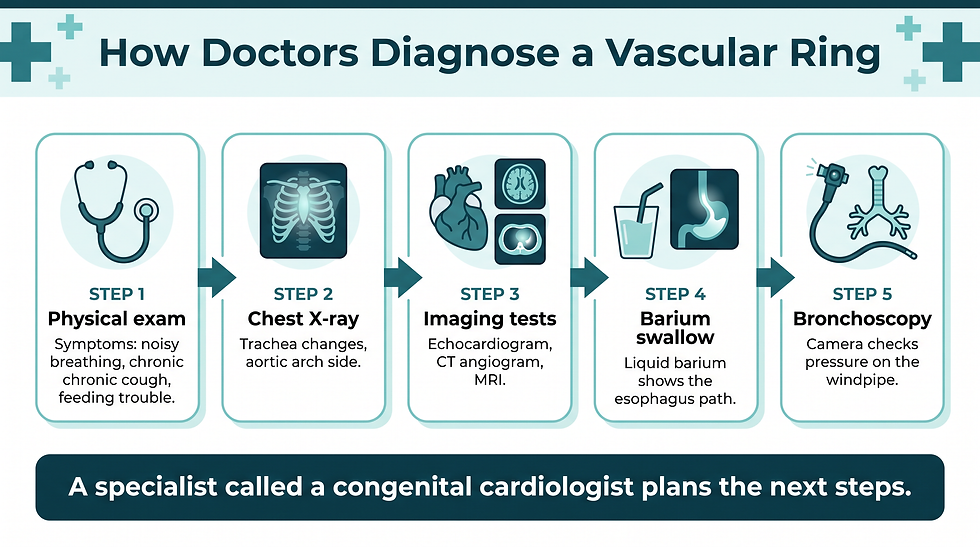 Infographic of five steps doctors use to diagnose a vascular ring: a physical exam for symptoms like noisy breathing, chronic cough and feeding trouble; a chest X-ray to check for windpipe changes and which side the aortic arch is on; imaging tests such as echocardiogram, CT angiogram and MRI; a barium swallow to show the path of the esophagus; and bronchoscopy to check for pressure on the windpipe; a congenital cardiologist plans the next steps