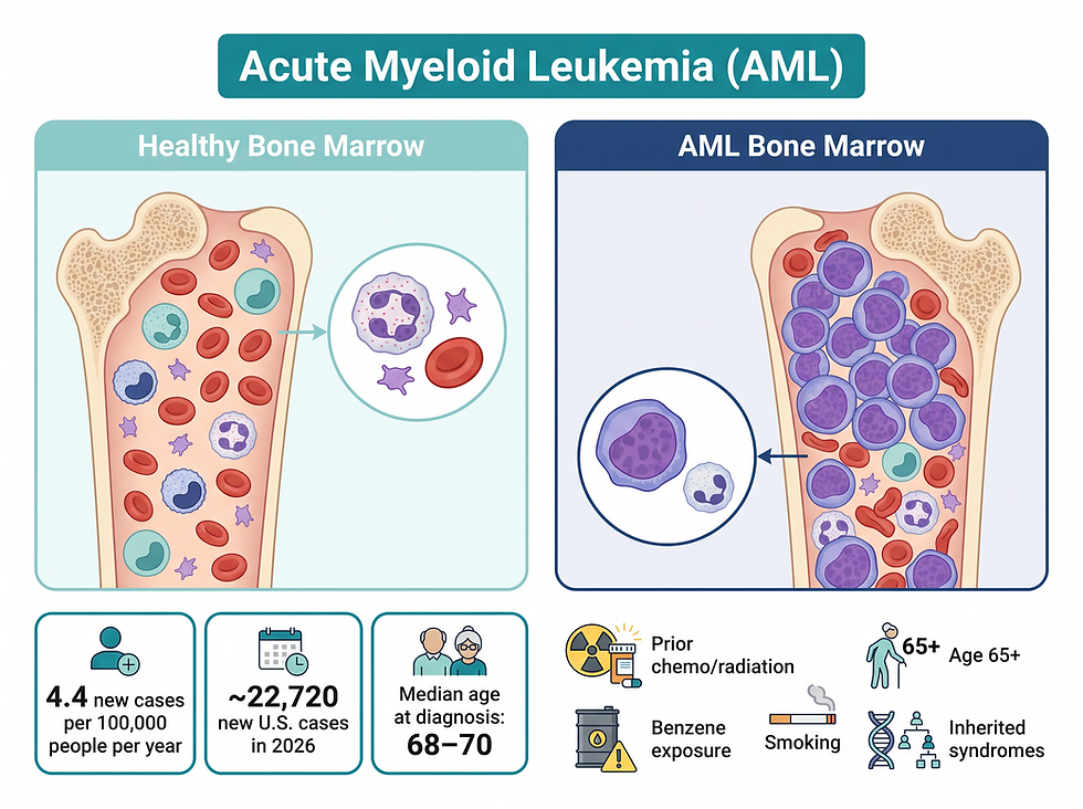 AML overview infographic showing how abnormal blast cells crowd out healthy blood cells, plus key incidence statistics and risk factors