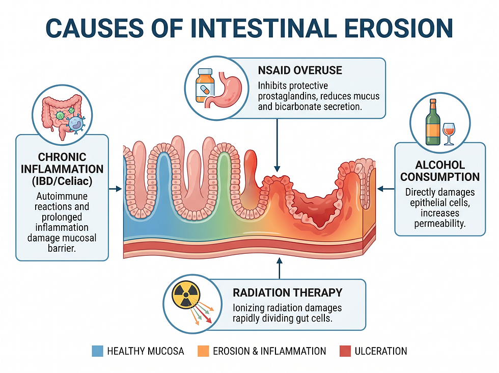 Causes of intestinal erosion, including chronic inflammation from IBD/Celiac, NSAID overuse, alcohol consumption, and radiation therapy.