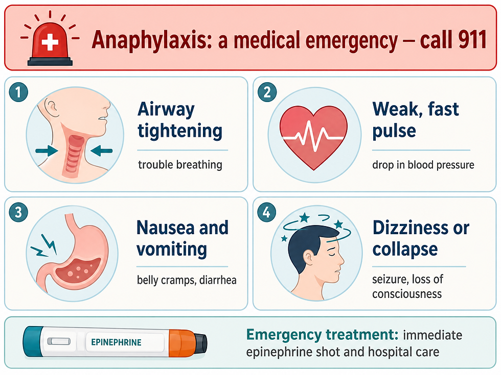 Emergency infographic for anaphylaxis with four warning sign cards: airway tightening (trouble breathing), weak fast pulse (blood pressure drop), nausea and vomiting (belly cramps, diarrhea), and dizziness or collapse (seizure, loss of consciousness), plus an emergency treatment strip for an immediate epinephrine shot.