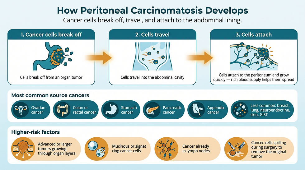 How peritoneal carcinomatosis develops, common source cancers, and higher-risk factors