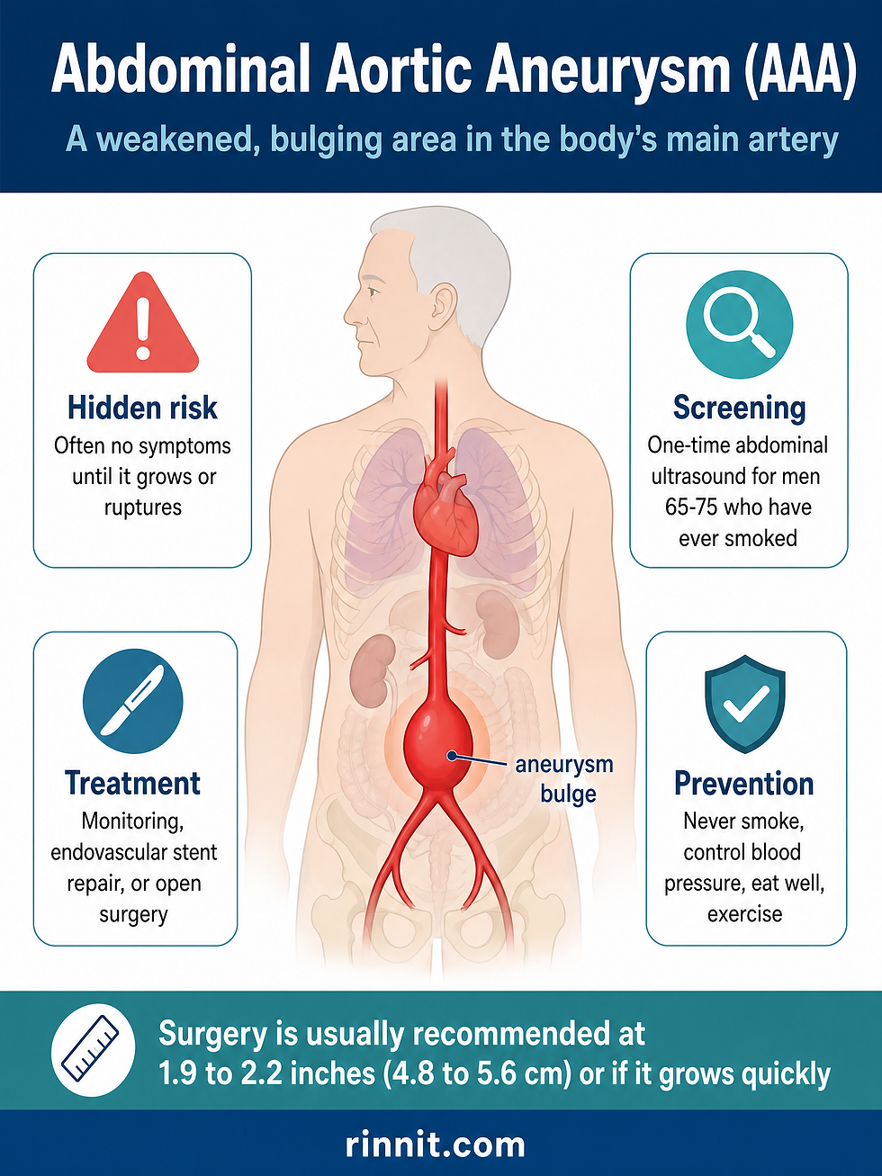 Abdominal aortic aneurysm (AAA) overview infographic showing the bulging aneurysm on the aorta, hidden-risk warning, screening guidance, treatment options, and prevention steps.