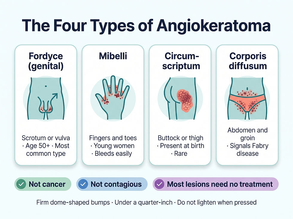 Angiokeratoma appearance: four types, what they look like, and reassuring features