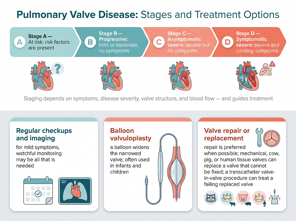 The four stages of heart valve disease and treatment options: monitoring, balloon valvuloplasty, valve repair or replacement
