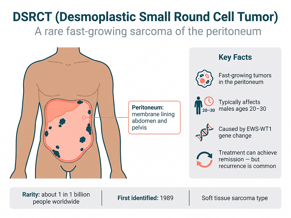 What is DSRCT: a rare fast-growing tumor that starts in the peritoneum lining the abdomen and pelvis, with key rarity statistics