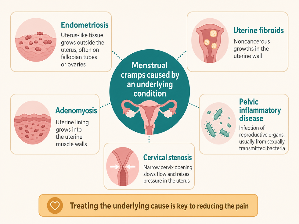 Five underlying conditions that can cause menstrual cramps: endometriosis, uterine fibroids, adenomyosis, pelvic inflammatory disease, and cervical stenosis — treating the underlying cause is key to reducing the pain.
