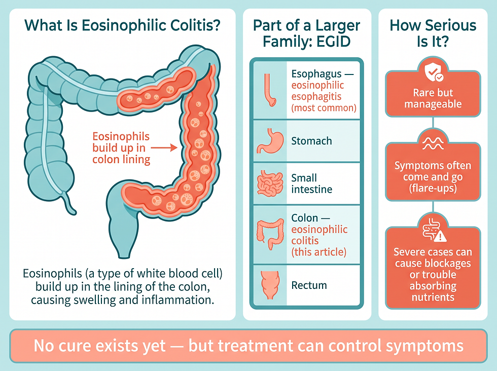 Eosinophilic colitis overview: inflammation in the colon caused by eosinophil buildup, severity range, and key facts