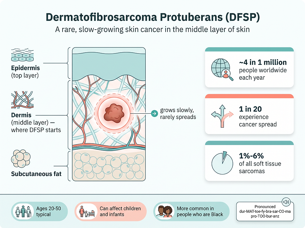What dermatofibrosarcoma protuberans (DFSP) is: a rare, slow-growing skin cancer that starts in the dermis, with key facts on how common it is and how rarely it spreads