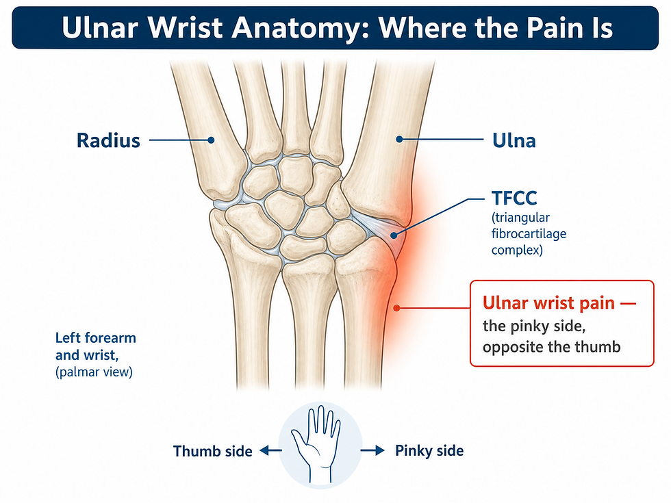 An anatomy diagram of the left forearm and wrist viewed from the palm side — the radius on the thumb side and the ulna on the pinky side, with the triangular fibrocartilage complex (TFCC) labeled at the ulnar side of the wrist joint