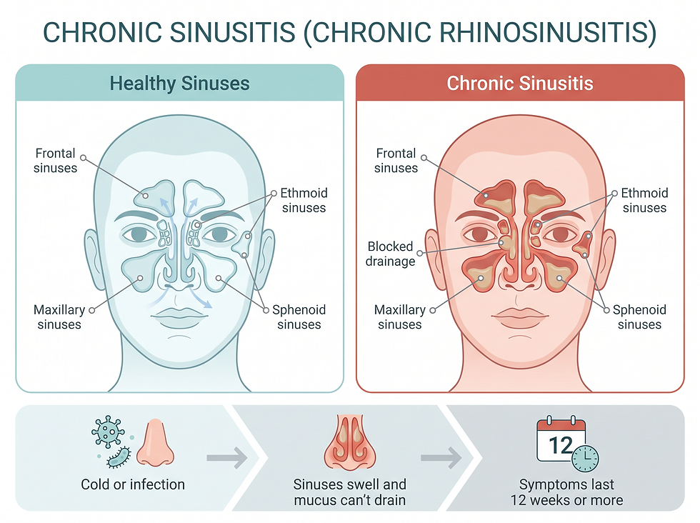 Healthy sinuses versus chronic sinusitis diagram