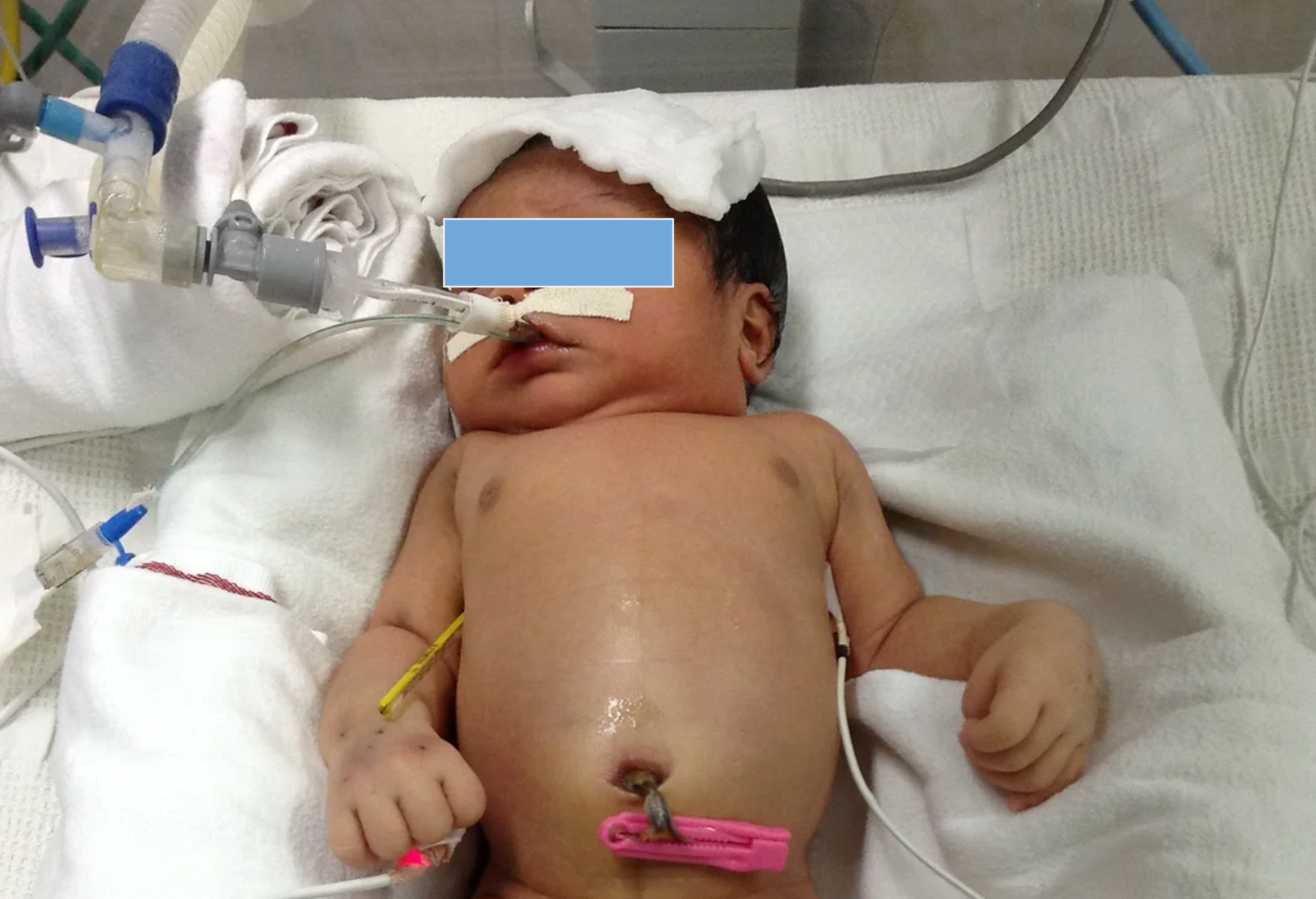 3D Anatomical Model of Brain Regions and Connections, image size:1826x1248