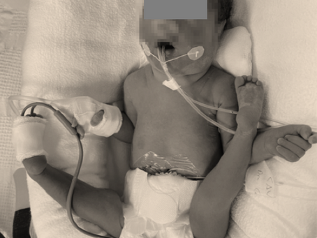 #41 Los bebés que no se mueven: reconociendo la hipokinesia fetal