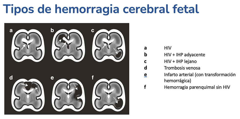 Adaptado de Dunbar M. Pediatrics Res, 2025.