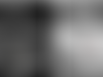 #218 CASO DEL MES: un recién nacido con hipotonía y apneas