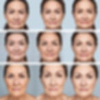 Anti-Wrinkle Injection.jpg