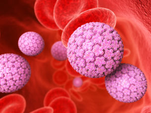 子宮頸癌檢查及治療 | 子宮頸癌病徵 | 醫健頻道