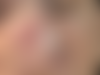 Coming May 2026 - CellStory Korean Liquid Microneedling